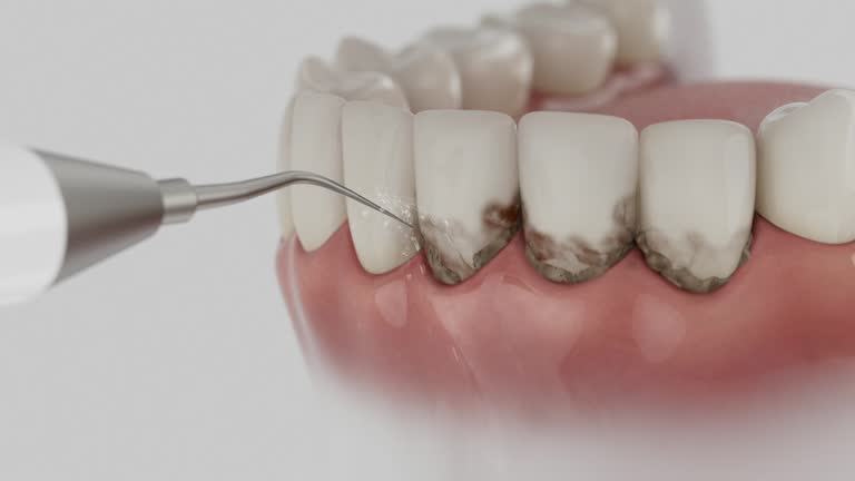 Trusted Tooth Extraction service in Rolla, ND - Dentist Open Now